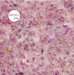 Batalj