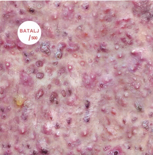 Batalj