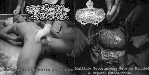 Multiple Subcutaneous Cuts On Mangled & Exposed Ostosibrotma / 1 Week Pregnancy : Investigating The Causes Of Death