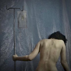 Patient 58
