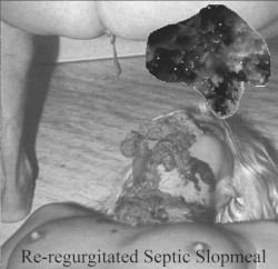 Re-regurgitated Septic Slopmeal