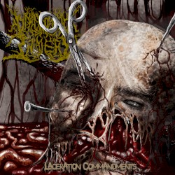Laceration Commandments
