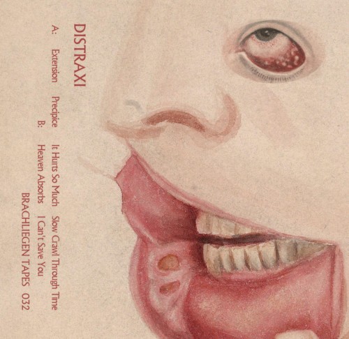 Distraxi