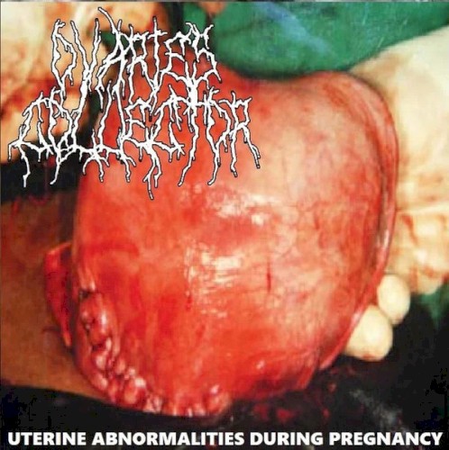 Uterine Abnormalities During Pregnancy