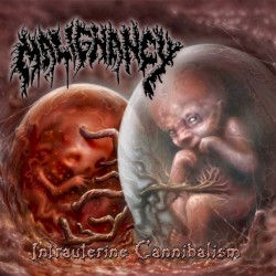 Intrauterine Cannibalism