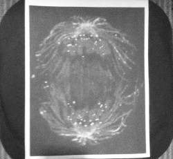 Anaphase EP