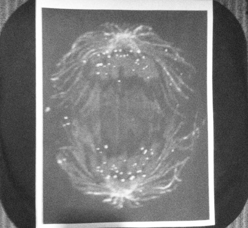 Anaphase EP