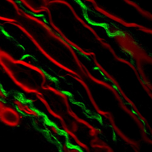 myelination 2