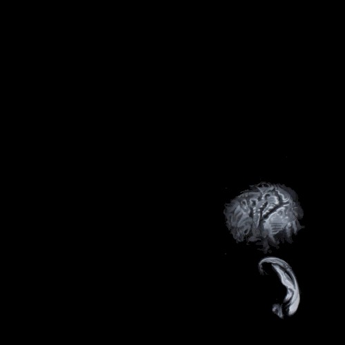Hypnagogia