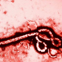 The Human Strain