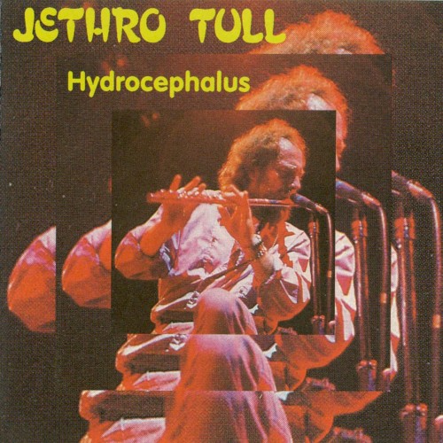 Hydrocephalus
