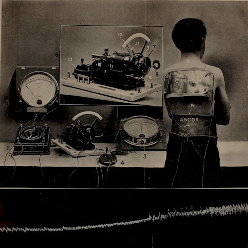 Electroanaesthesia