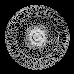 Hypersomnia