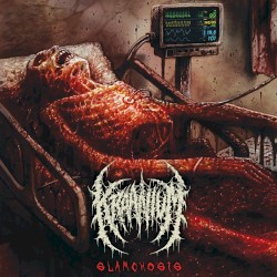 Slamchosis