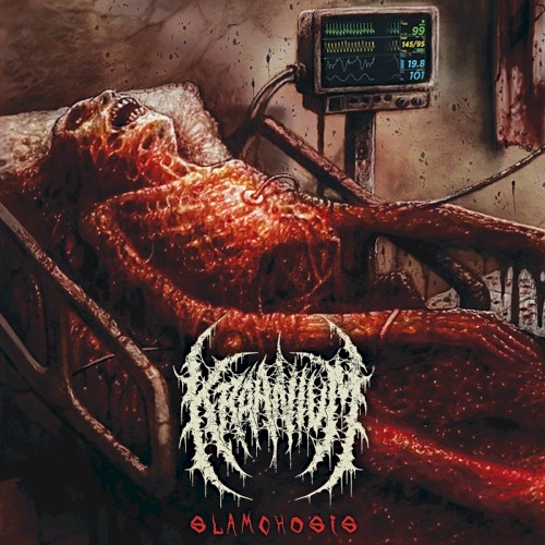 Slamchosis