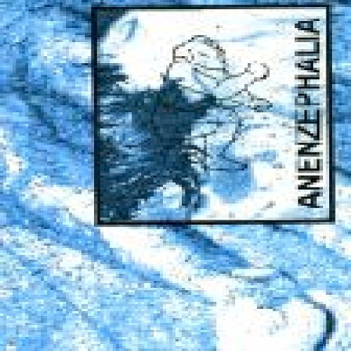 Live in Karlsruhe, Germany 8-10-1993