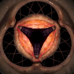 Aperture
