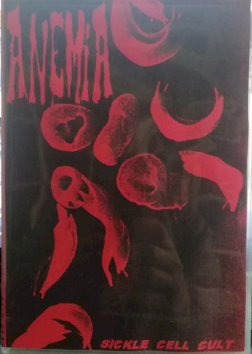 Sickle Cell Cut