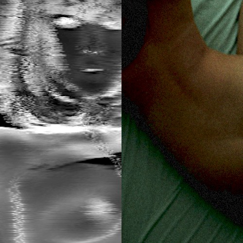 Born from Frustration/Live In My Room