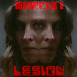 Lesion