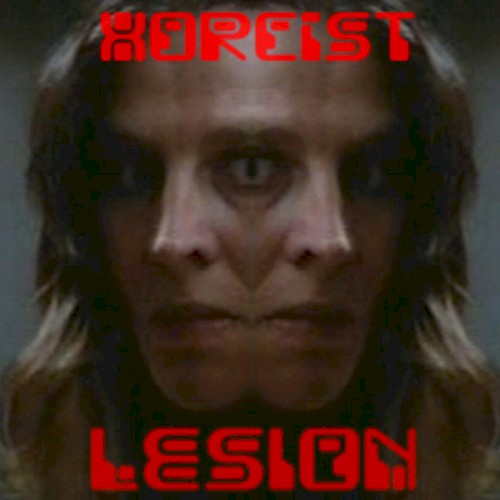 Lesion