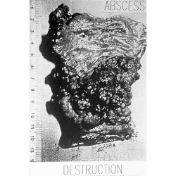 Destruction