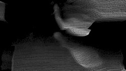 Organ Excision