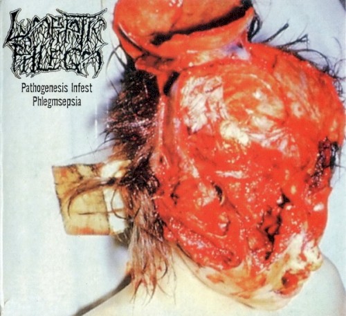Pathogenesis Infest Phlegmsepia
