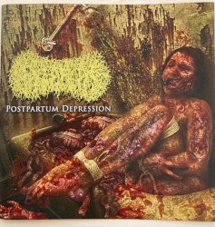 Postpartum Depression