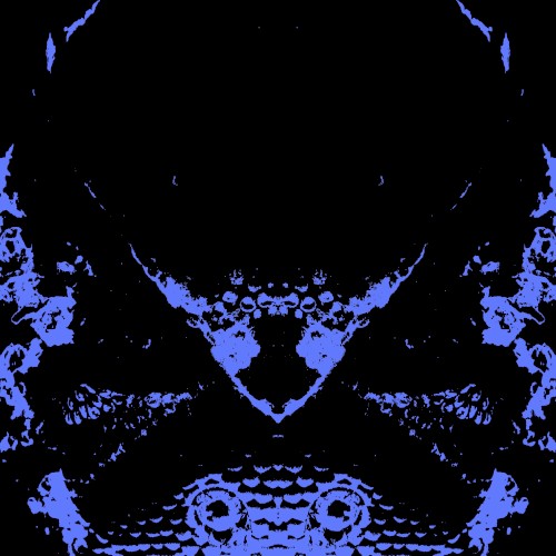 Hypersomnia