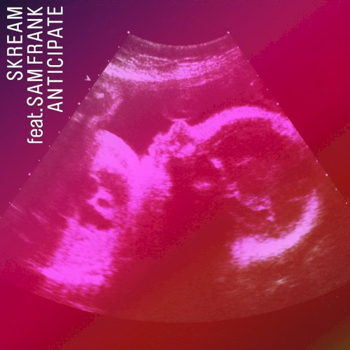 Anticipate