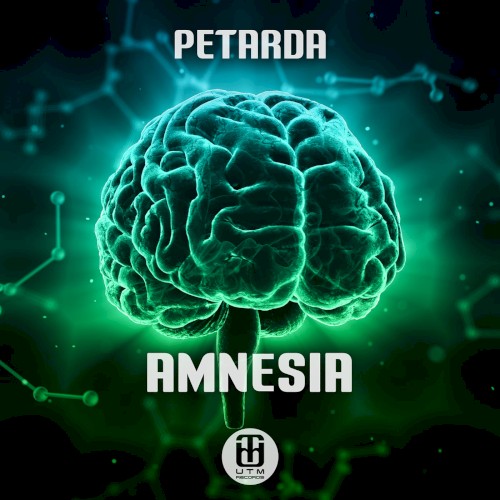 Amnesia