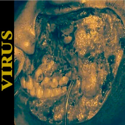 Virus