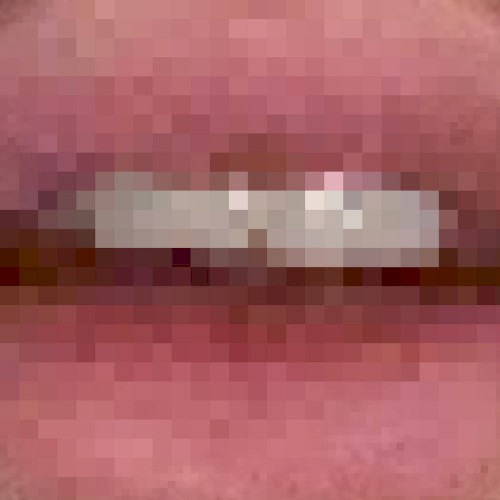 TEETH