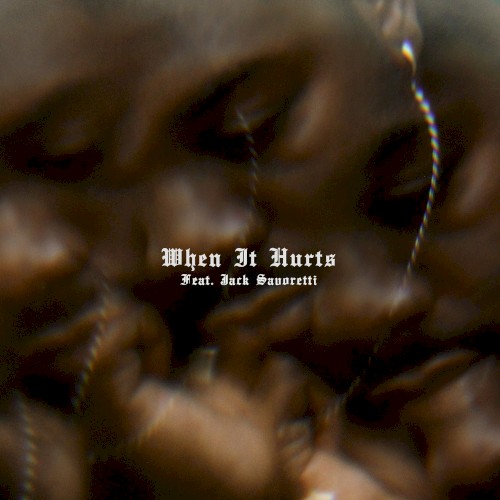 WHEN IT HURTS