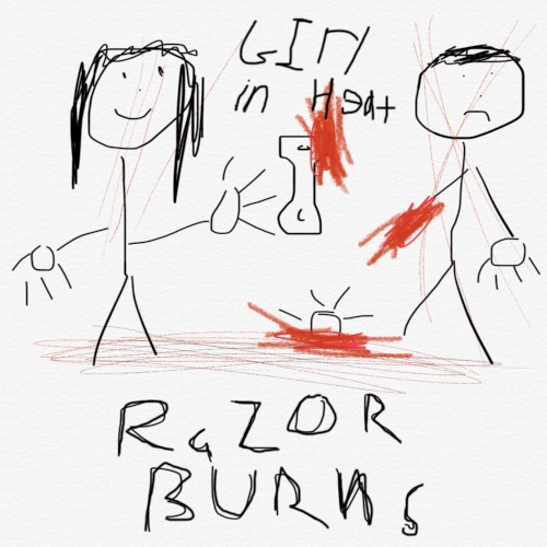 Razor Burns