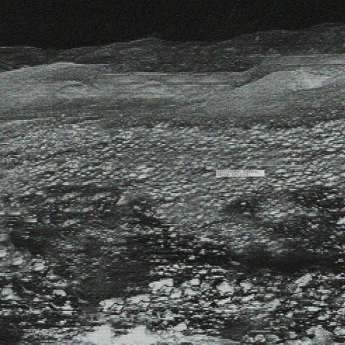 ZIGOUILLE & RACISME