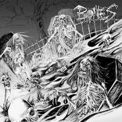 Bones