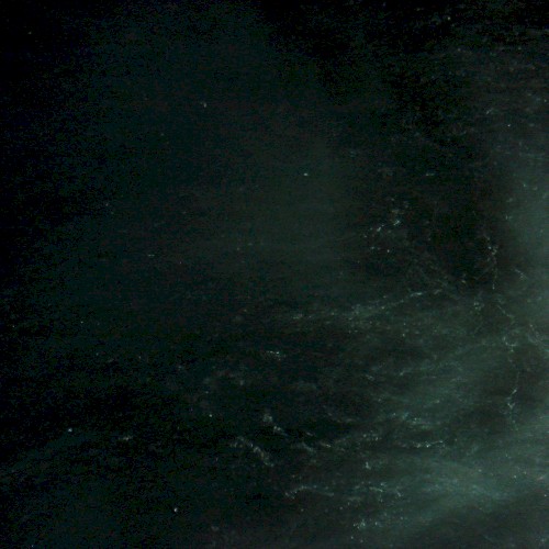 pyrexia