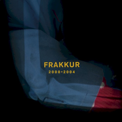 2000 - 2004
