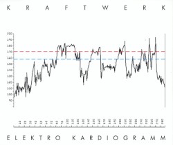 Elektro Kardiogramm