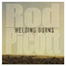 Welding Burns