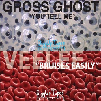 You Tell Me / Bruises Easily