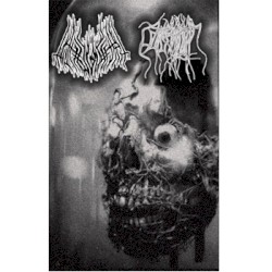 Pathogenesis / Parasitic Twin