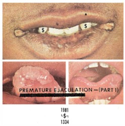 Premature Ejaculation - Part. 1