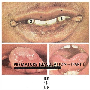 Premature Ejaculation - Part. 1
