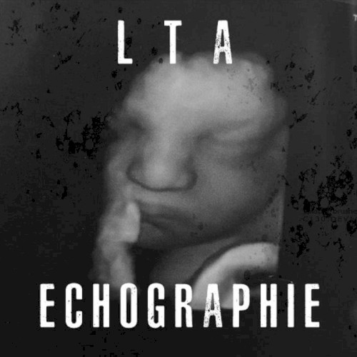 Echographie
