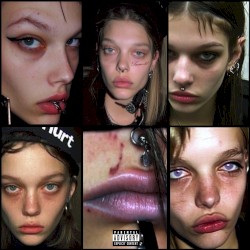 hurt