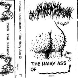 "The Hairy Ass of ________!"