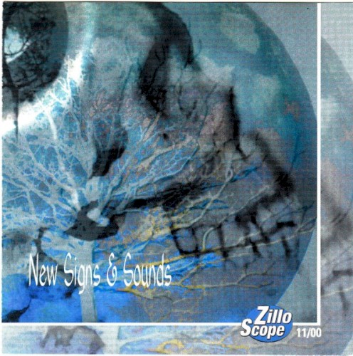 ZilloScope 11/00
